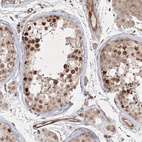 Anti-KIF20A Antibody