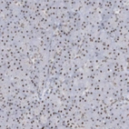 Anti-DCLRE1A Antibody