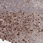 Immunohistochemical staining of human lymph node shows strong nuclear positivity in germinal center cells.