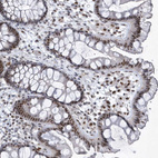 Immunohistochemical staining of human colon shows strong nuclear positivity in glandular cells.
