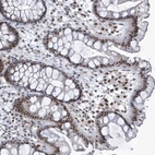 Immunohistochemical staining of human colon shows strong nuclear positivity in glandular cells.