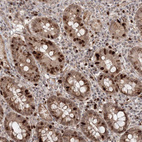 Anti-KIF20A Antibody