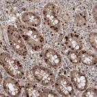 Immunohistochemical staining of human duodenum shows strong nuclear positivity in subset of glandular cells.
