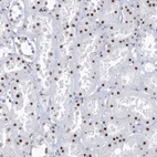 Immunohistochemical staining of human kidney shows strong nuclear positivity in cells in tubules.