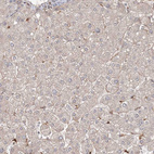 Immunohistochemical staining of human liver shows very weak positivity in hepatocytes as expected.
