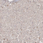 Immunohistochemical staining of human liver shows very weak positivity in hepatocytes as expected.
