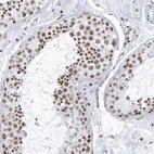 Immunohistochemical staining of human testis shows strong nuclear positivity in cells in seminiferous ducts.