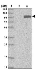 Lane 1: Marker [kDa] 230, 130, 95, 72, 56, 36, 28, 17, 11_br/_Lane 2: Human cell line RT-4_br/_Lane 3: Human cell line U-251MG sp