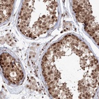 Anti-KIF20A Antibody