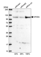 Western blot analysis in U2OS cells transfected with control siRNA, target specific siRNA probe #1 and #2, using Anti-KIF20A antibody. Remaining relative intensity is presented.