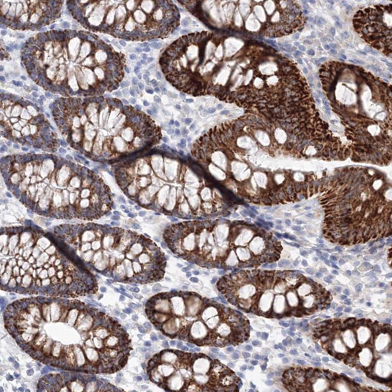 Anti-HMGCS1 Antibody