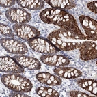 Anti-HMGCS1 Antibody