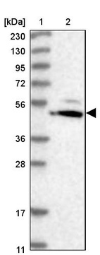 Lane 1: Marker [kDa] 230, 130, 95, 72, 56, 36, 28, 17, 11_br/_Lane 2: Human cell line RT-4