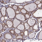 Immunohistochemical staining of human thyroid gland shows high expression.