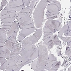 Immunohistochemical staining of human skeletal muscle shows low expression as expected.