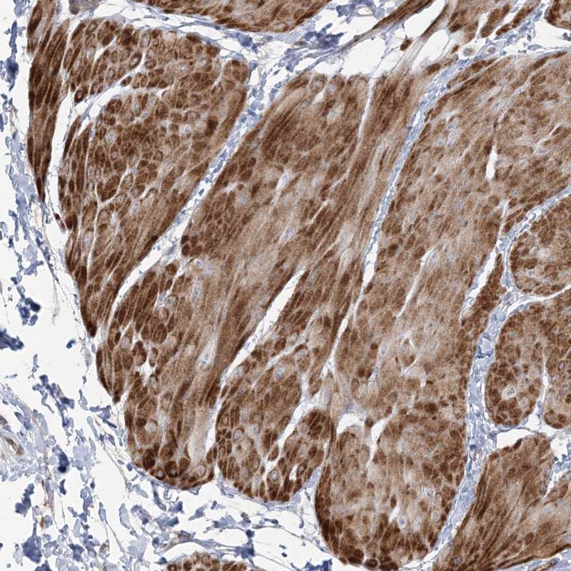 Anti-NUDT9 Antibody
