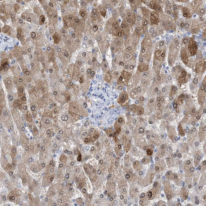 Anti-HMGCS1 Antibody