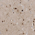 Immunohistochemical staining of human cerebral cortex shows moderate to strong cytoplasmic positivity in neurons.