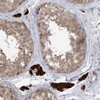 Immunohistochemical staining of human testis shows strong cytoplasmic positivity in Leydig cells.