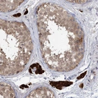 Immunohistochemical staining of human testis shows strong cytoplasmic positivity in Leydig cells.