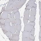 Immunohistochemical staining of human skeletal muscle shows no positivity in myocytes as expected.