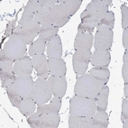 Immunohistochemical staining of human skeletal muscle shows no positivity in myocytes as expected.