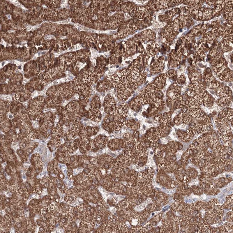 Anti-PSMD6 Antibody