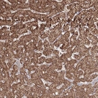 Anti-PSMD6 Antibody