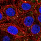 Immunofluorescent staining of human cell line MCF7 shows localization to vesicles.