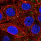 Immunofluorescent staining of human cell line MCF7 shows localization to vesicles.