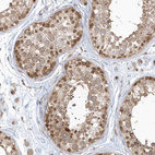 Anti-PSMD6 Antibody