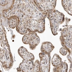 Immunohistochemical staining of human placenta shows moderate cytoplasmic positivity in trophoblastic cells.