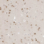 Immunohistochemical staining of human cerebral cortex shows moderate nuclear positivity in neurons.