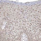 Immunohistochemical staining of human skin shows weak to moderate nuclear positivity in squamous epithelial cells.