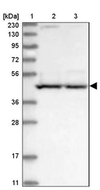 Lane 1: Marker [kDa] 230, 130, 95, 72, 56, 36, 28, 17, 11_br/_Lane 2: Human cell line RT-4_br/_Lane 3: Human cell line U-251MG sp