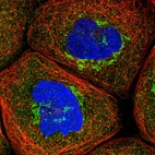 Immunofluorescent staining of human cell line A-431 shows localization to the Golgi apparatus & vesicles.