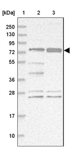 Lane 1: Marker [kDa] 250, 130, 95, 72, 55, 36, 28, 17, 10_br/_Lane 2: Human cell line RT-4_br/_Lane 3: Human cell line U-251 MG