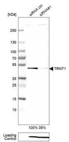 Western blot analysis in A-549 cells transfected with control siRNA, target specific siRNA probe #1, using Anti-TRNT1 antibody. Remaining relative intensity is presented. Loading control: Anti-PPIB.