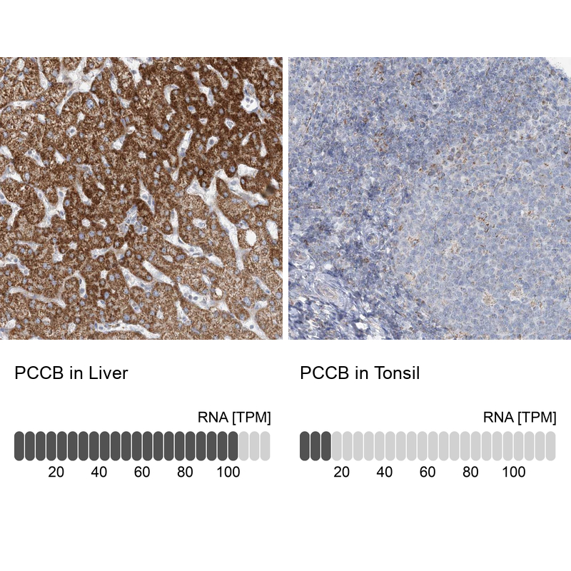 Anti-PCCB Antibody