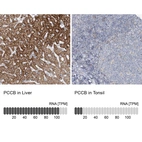 Anti-PCCB Antibody