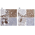 Immunohistochemical staining of human kidney, liver, salivary gland and tonsil using Anti-PCCB antibody HPA036939 (A) shows similar protein distribution across tissues to independent antibody HPA036940 (B).