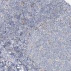 Immunohistochemical staining of human tonsil shows low expression as expected.