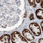Immunohistochemical staining of human kidney using Anti-PCCB antibody HPA036939.