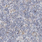 Immunohistochemical staining of human tonsil using Anti-PCCB antibody HPA036939.