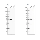 Western blot analysis using Anti-PCCB antibody HPA036939 (A) shows similar pattern to independent antibody HPA036940 (B).