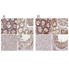 Anti-CEP70 Antibody