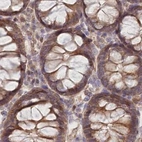 Immunohistochemical staining of human colon using Anti-CEP70 antibody HPA036941.