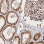 Immunohistochemical staining of human kidney using Anti-CEP70 antibody HPA036941.
