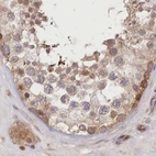 Immunohistochemical staining of human testis using Anti-CEP70 antibody HPA036941.