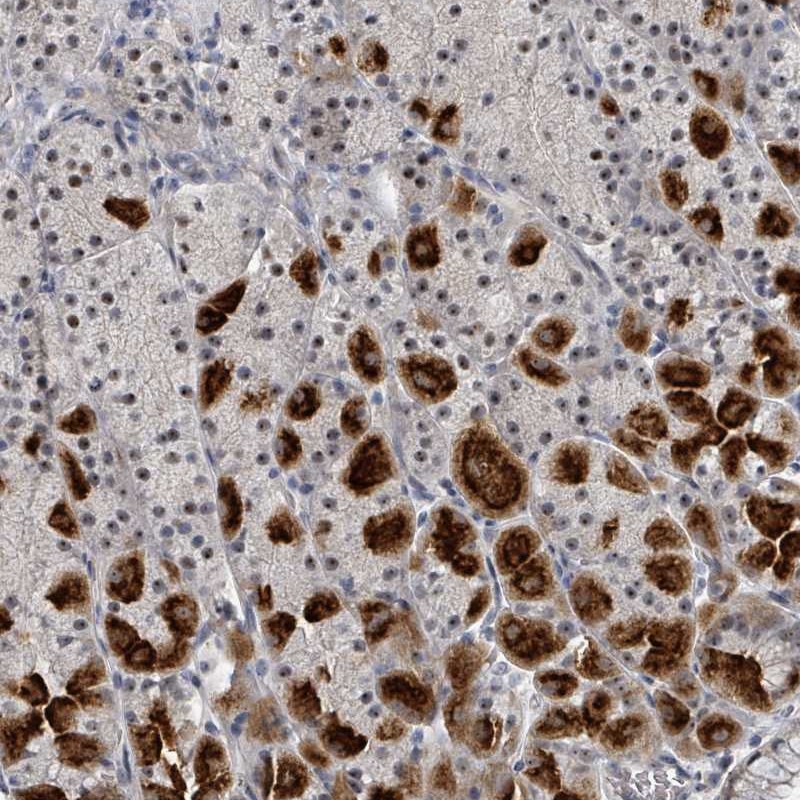 Anti-TRDMT1 Antibody